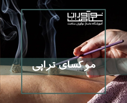 اجرای موکسای تراپی